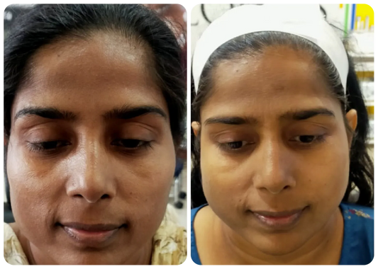 DERMA ONE GOLD SKIN POLISH