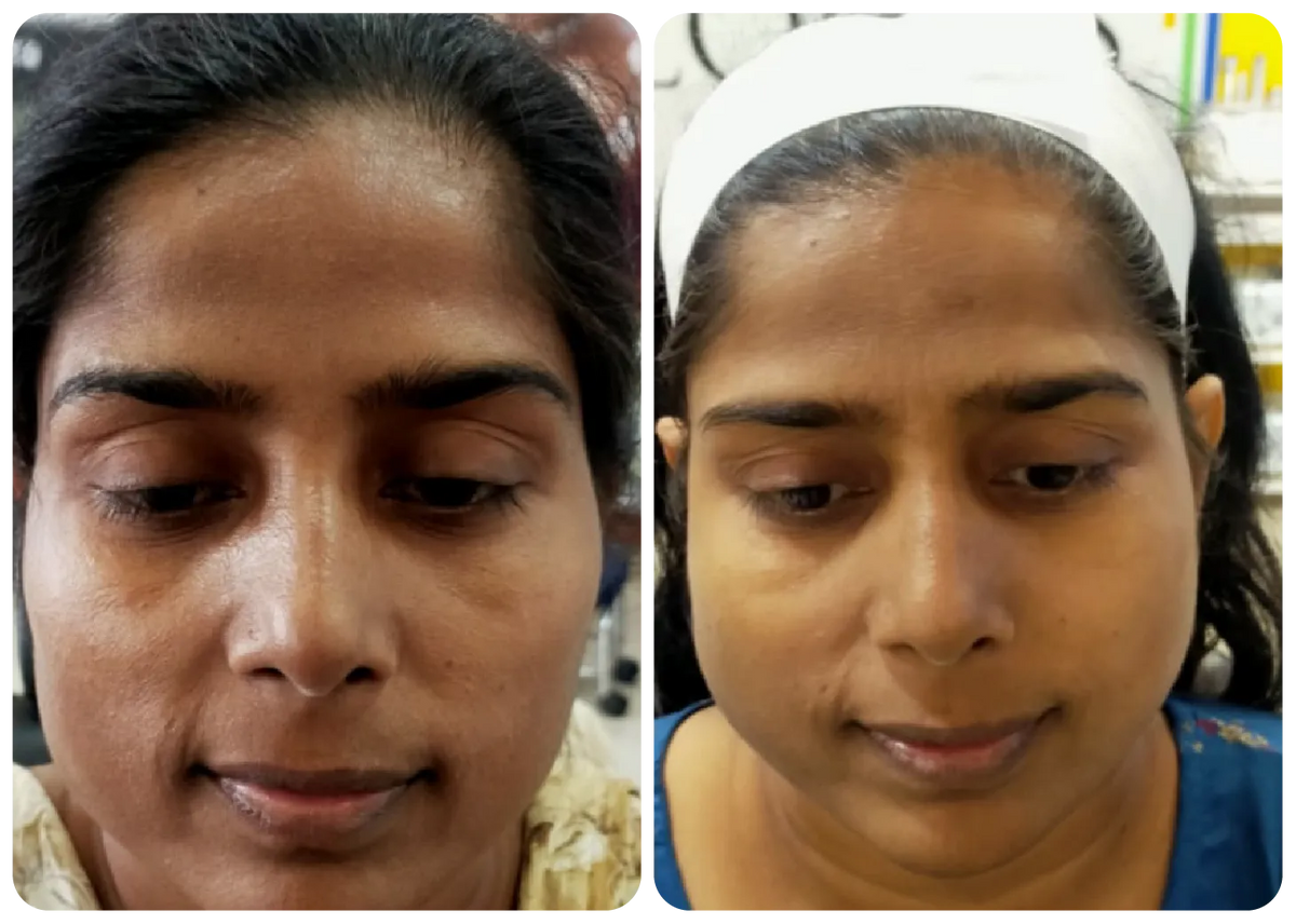 DERMA ONE GOLD SKIN POLISH